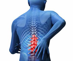 Image representing a back injury case handled by a Kentucky spinal injury lawyer