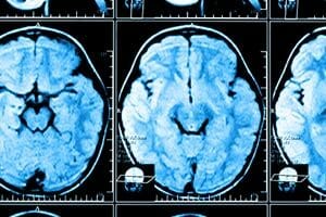 Billy Johnson Law: Internal Injuries & Organ Damage