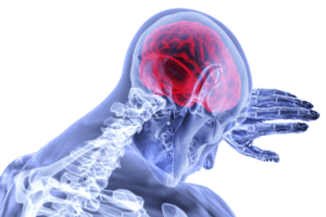 Kentucky TBI Victim Helps Others through Advocacy