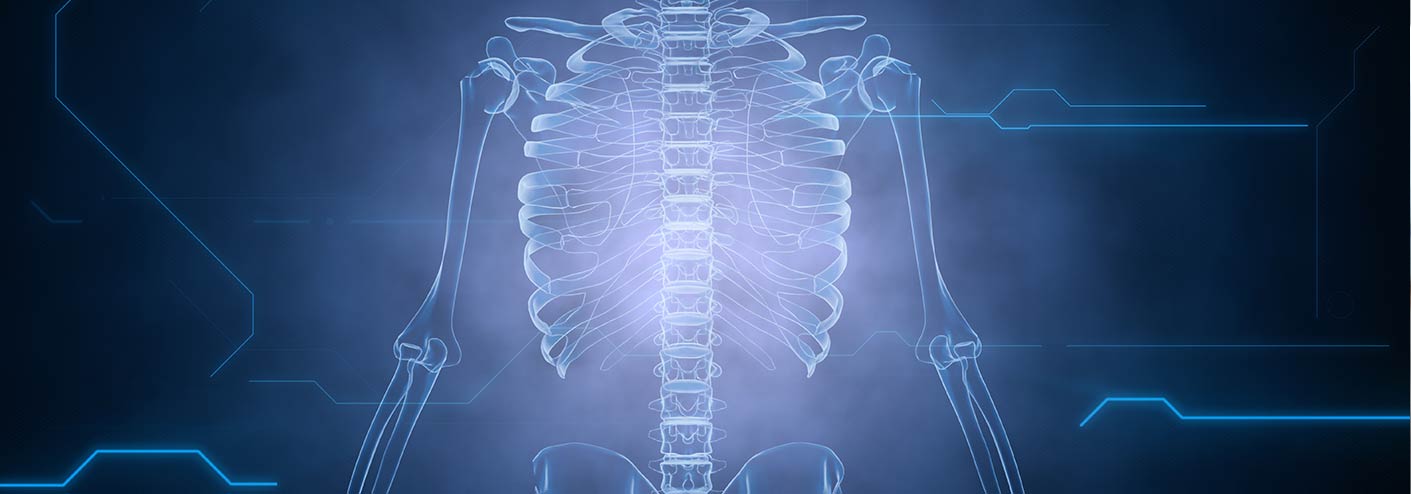 Kentucky Spine & Back Injury Lawyer